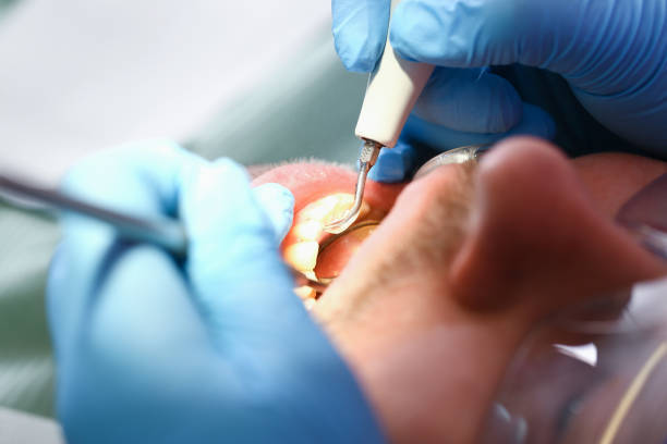 Best Urgent Care for Lost Fillings or Crowns in Fountain Inn, SC