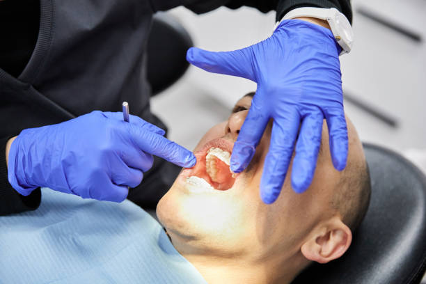 Best Emergency Tooth Extraction in Fountain Inn, SC